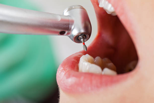 Best Emergency Dental Care for Abscessed Tooth in Olivet, TN